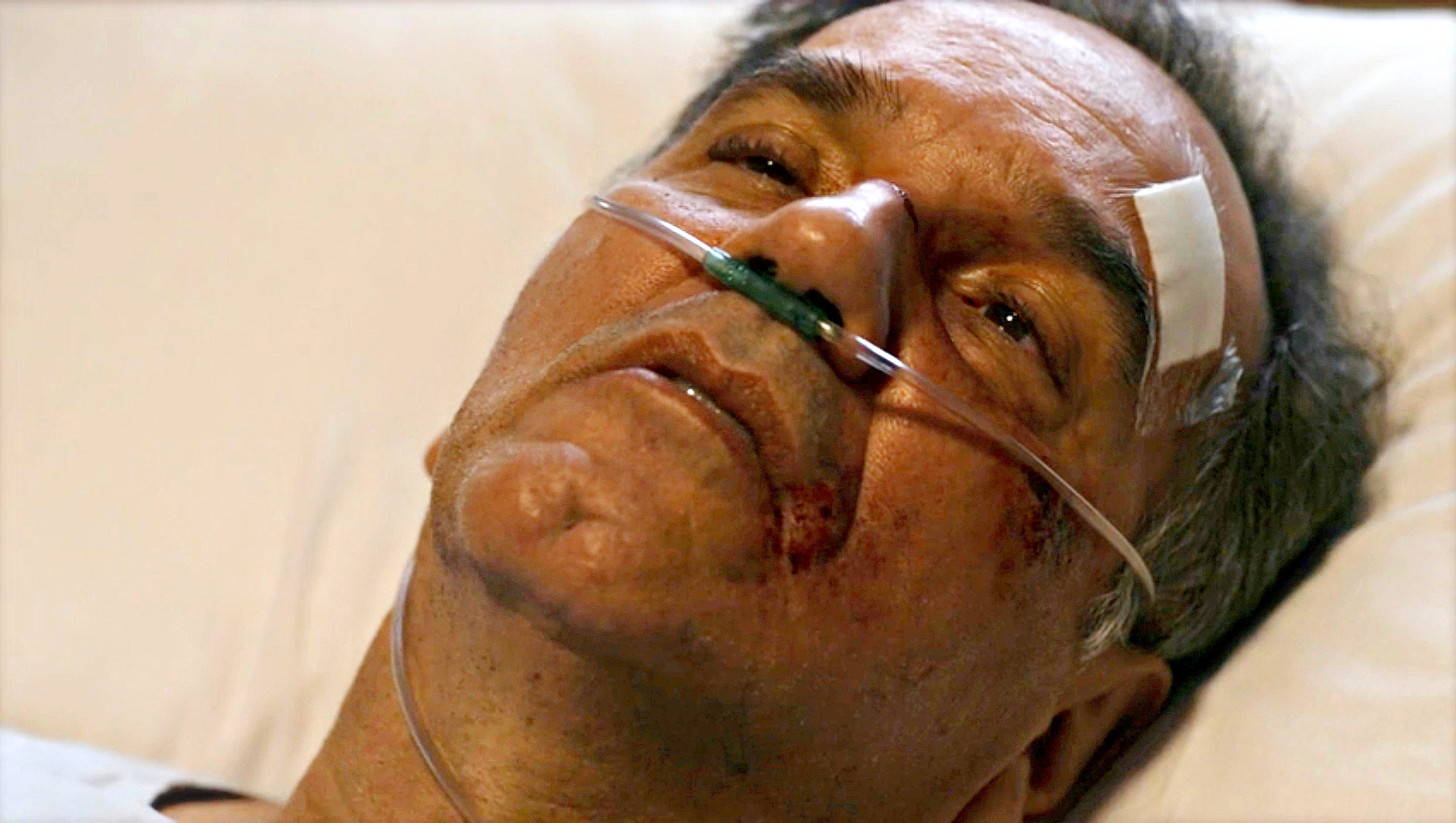 Na novela Travessia, Guerra, personagem de Humberto Martins, aparece em uma cama de hospital, com ferimentos no rosto e respirando com a ajuda de cilindro de oxigênio.